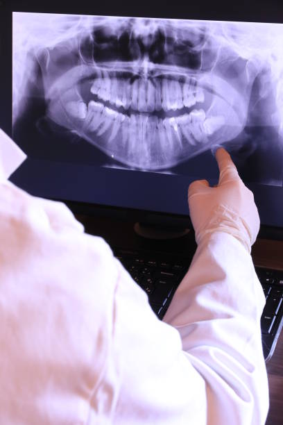 Best Knocked-Out Tooth Emergency  in Leesville, LA