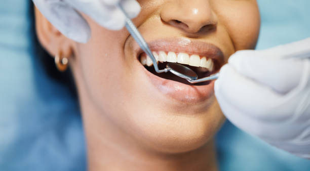 Best Root Canal Emergency Dentist  in Leesville, LA